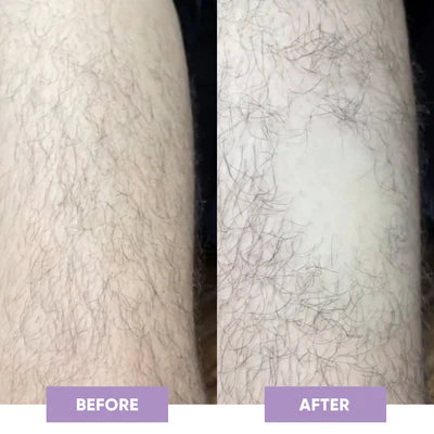 ARM SKIN