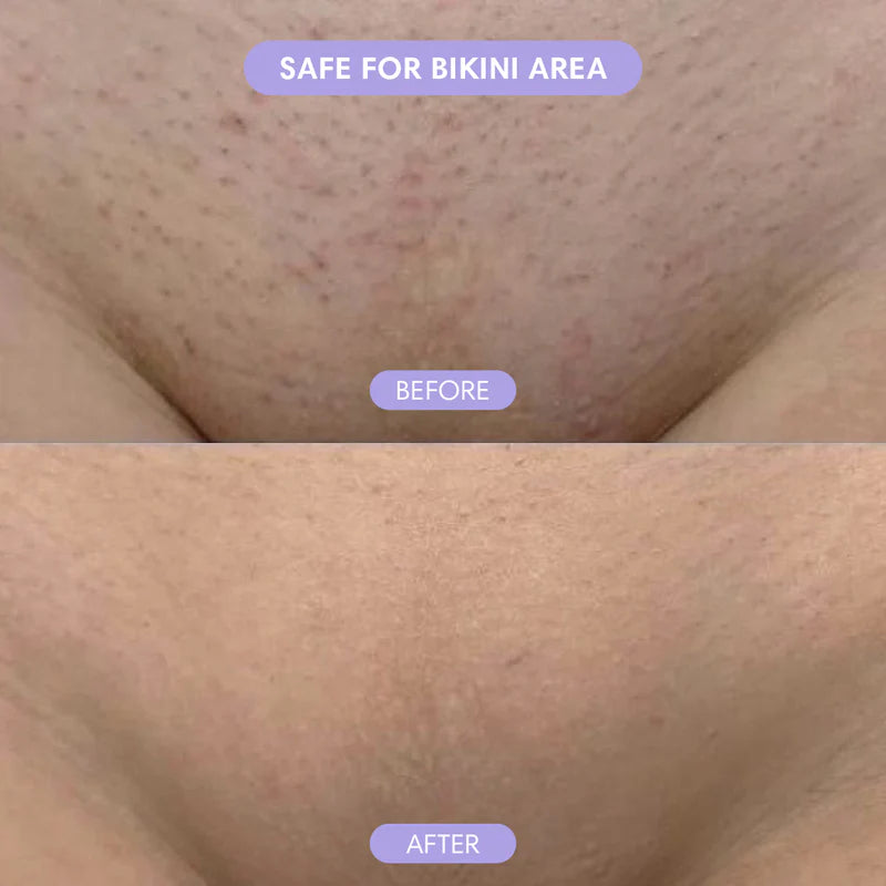 BIKINI AREA