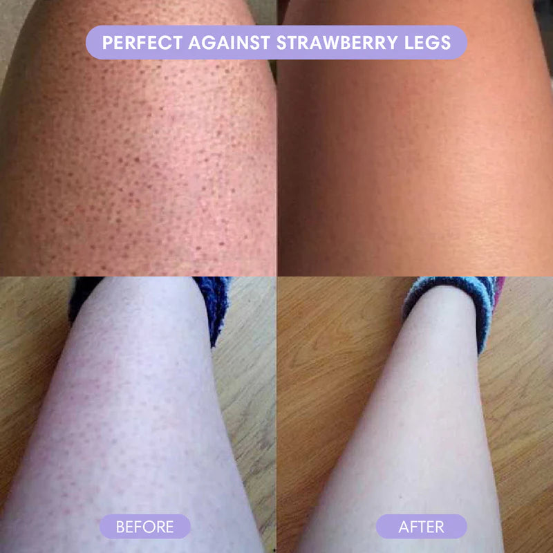 STRAWBERRY LEGS